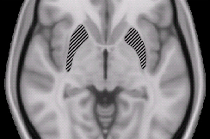 cerebro humano